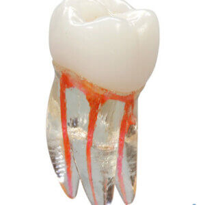 Endo tooth