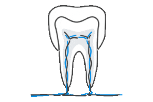 Endodontics Products Category